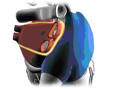 Методика “box lesion” Методика “box lesion”
